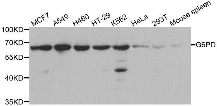 Anti-G6PD Antibody