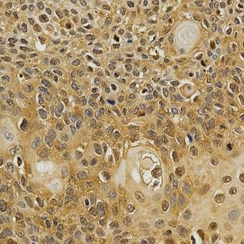 Anti-NFATC1 Antibody