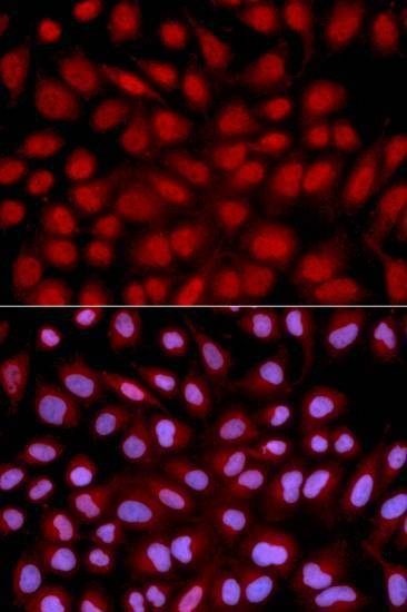 Anti-NFATC1 Antibody