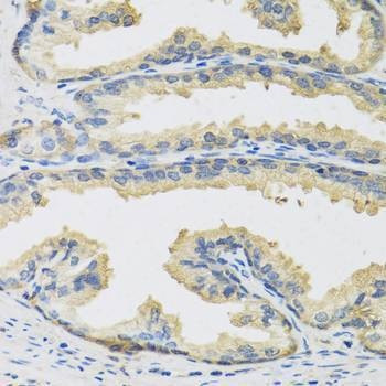 Anti-CST3 Antibody