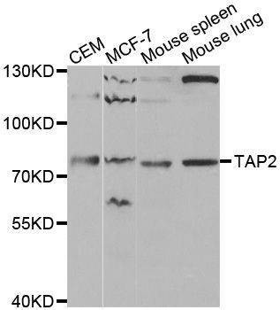 Anti-TAP2 Antibody