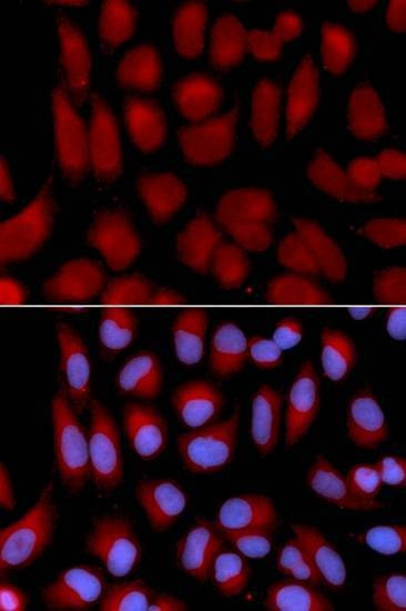 Anti-TAP2 Antibody