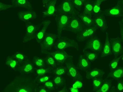 Anti-RFC1 Antibody