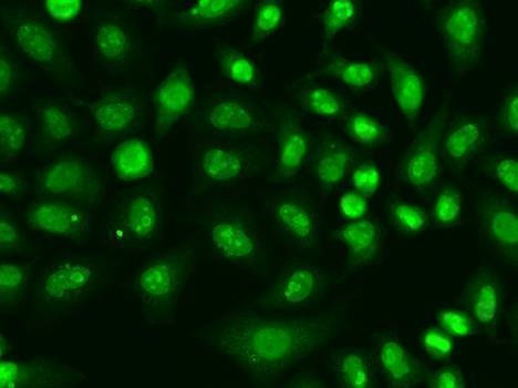 Anti-RFC1 Antibody
