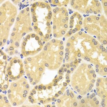 Anti-IDE Antibody