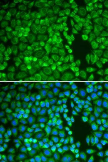 Anti-IDE Antibody