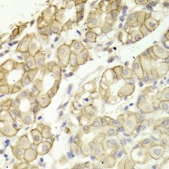 Anti-CTNND1 Antibody
