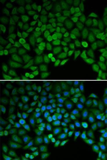 Anti-CTNND1 Antibody