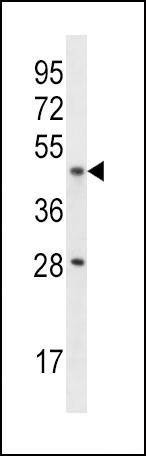 Anti-IL9R (Center) Antibody