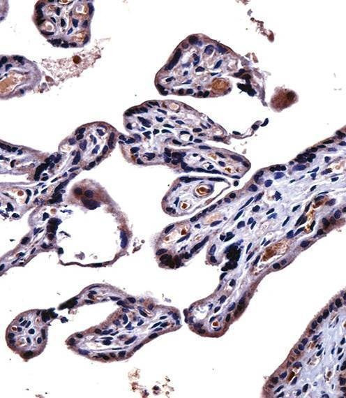 Anti-IL9R (Center) Antibody