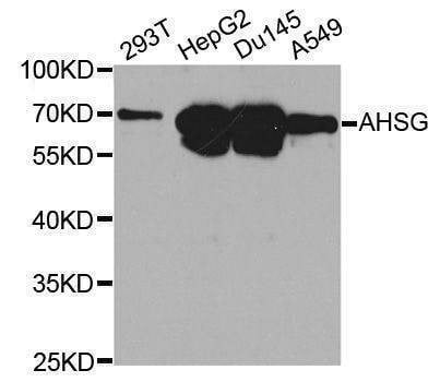 Anti-AHSG Antibody