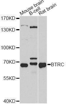 Anti-BTRC Antibody