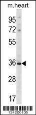 Anti-DLX5 (Center) Antibody