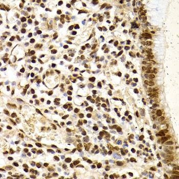 Anti-XRCC4 Antibody