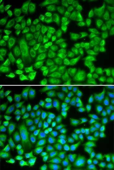 Anti-KAT5 Antibody