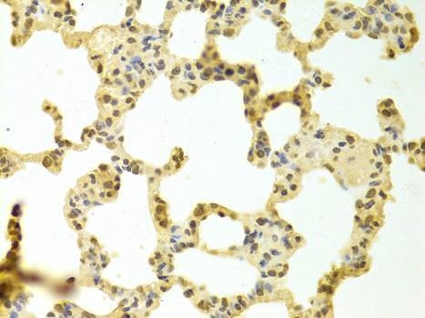 Anti-HNRNPK Antibody