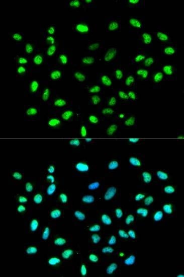 Anti-HNRNPK Antibody