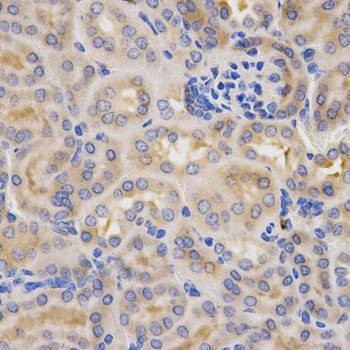 Anti-CFB Antibody
