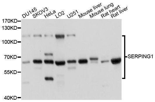 Anti-SERPING1 Antibody