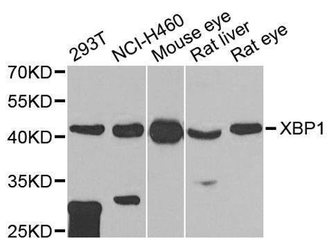 Anti-XBP1 Antibody