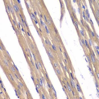 Anti-FXN Antibody