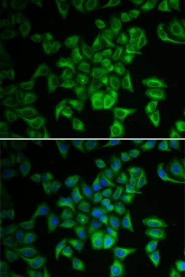 Anti-FXN Antibody