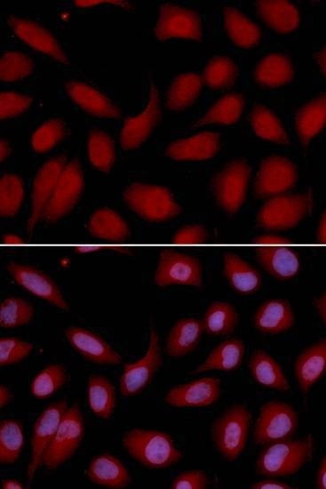Anti-CD3E Antibody