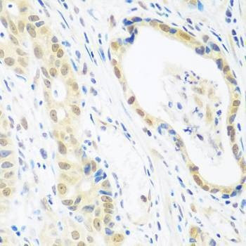 Anti-POLR2E Antibody
