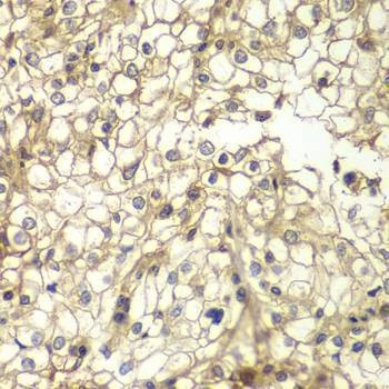 Anti-CD1D Antibody