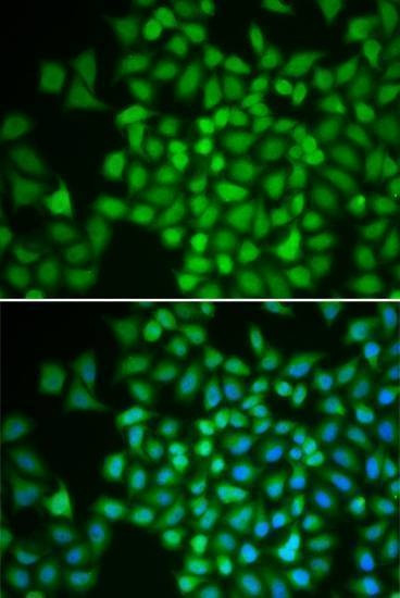 Anti-COPS5 Antibody