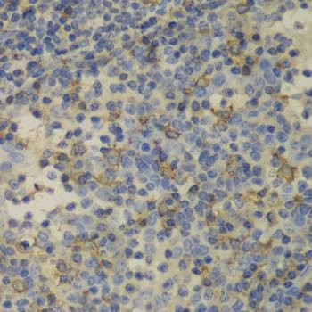 Anti-FTL Antibody