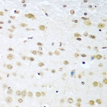 Anti-CCND2 Antibody