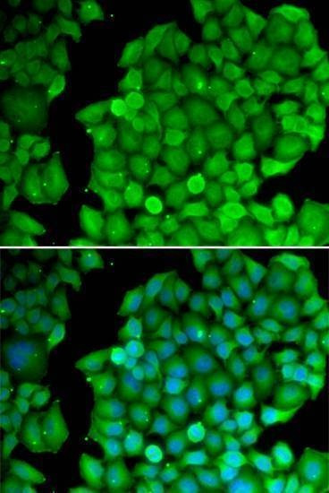 Anti-CCND2 Antibody