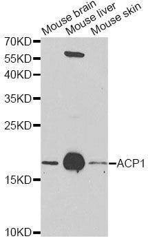 Anti-ACP1 Antibody