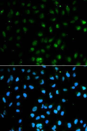 Anti-PTPN2 Antibody