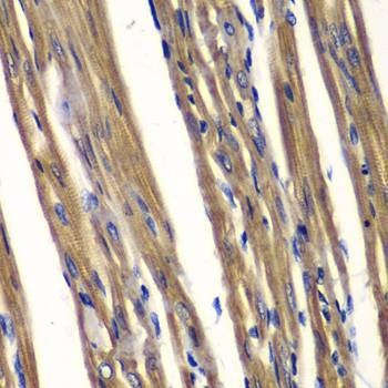 Anti-PTPN2 Antibody