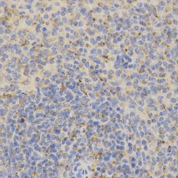 Anti-PSAP Antibody
