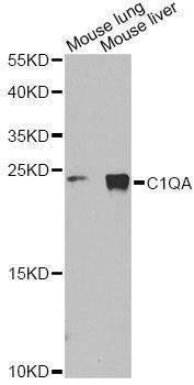 Anti-C1QA Antibody