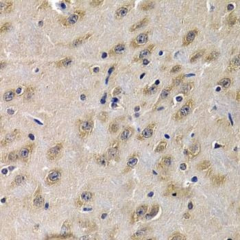 Anti-C1QA Antibody
