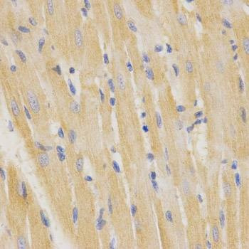 Anti-SFTPC Antibody