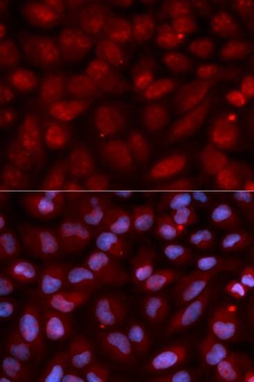 Anti-CD47 Antibody