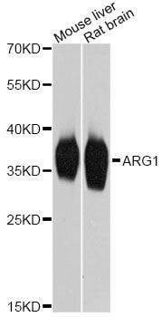 Anti-ARG1 Antibody