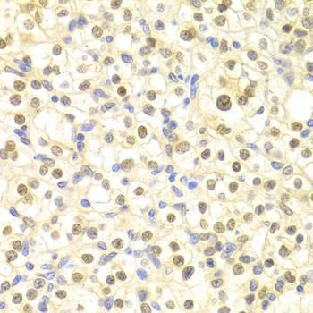 Anti-DDB2 Antibody