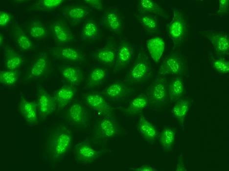 Anti-POLR2D Antibody