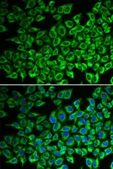 Anti-IL12RB1 Antibody