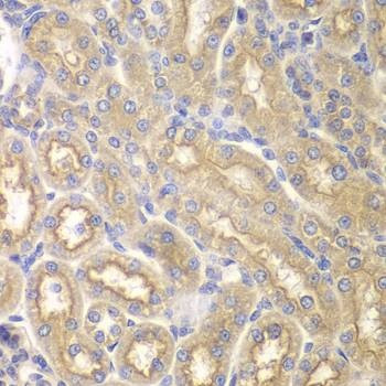 Anti-IL12RB1 Antibody