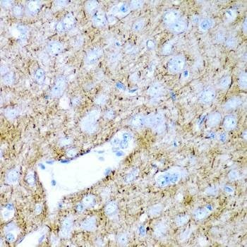 Anti-PTGDS Antibody