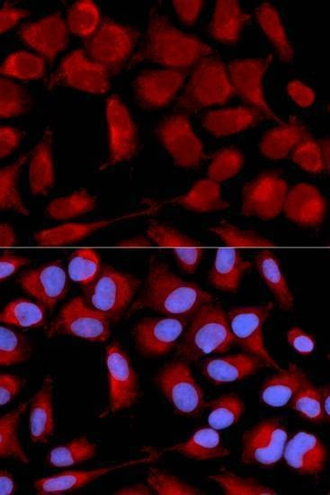 Anti-PDHA1 Antibody