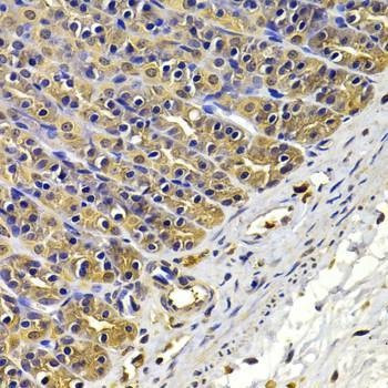 Anti-FSCN1 Antibody