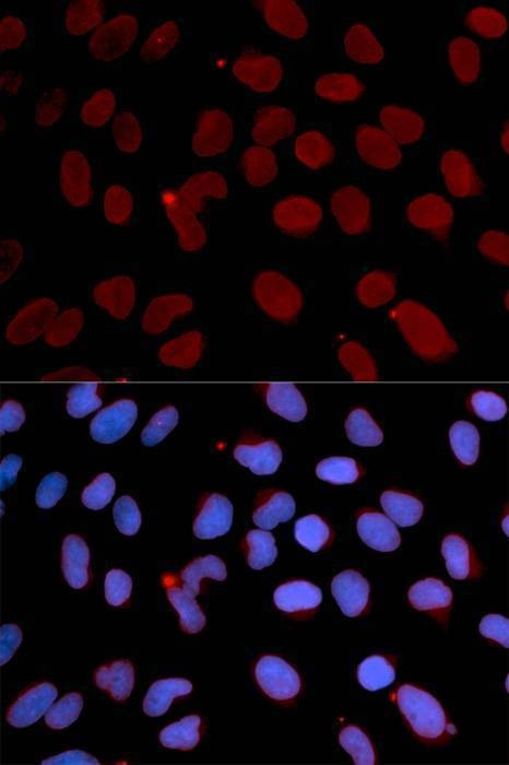 Anti-LMNB1 Antibody